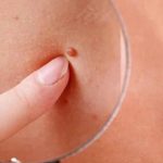 kliniki-episkopisi-spilon-ezgif.com-webp-to-jpg-converter